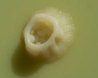 mycobacterium mycobacterium colony